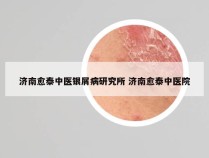 济南愈泰中医银屑病研究所 济南愈泰中医院