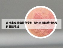 吉林市皮肤病特色专科 吉林市皮肤病特色专科医院地址
