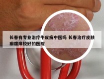 长春有专业治疗牛皮癣中医吗 长春治疗皮肤癣瘙痒较好的医院