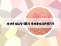 赤峰市皮肤专科医院 赤峰市皮肤病研究院
