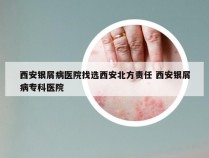 西安银屑病医院找选西安北方责任 西安银屑病专科医院
