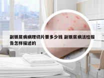 副银屑病病理切片要多少钱 副银屑病活检报告怎样描述的