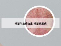 喝茶牛皮癣加重 喝茶银屑病
