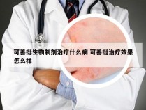 可善挺生物制剂治疗什么病 可善挺治疗效果怎么样