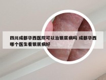 四川成都华西医院可以治银屑病吗 成都华西哪个医生看银屑病好