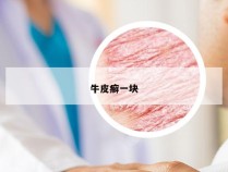 牛皮癣一块