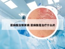 亚麻酸治银屑病 亚麻酸是治疗什么的