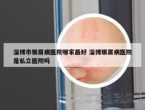 淄博市银屑病医院哪家最好 淄博银屑病医院是私立医院吗