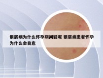 银屑病为什么怀孕期间轻呢 银屑病患者怀孕为什么会自愈