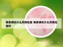 银屑病吃什么药做检查 银屑病吃什么药做检查好