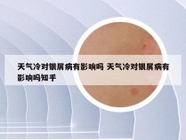 天气冷对银屑病有影响吗 天气冷对银屑病有影响吗知乎