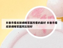 长春市看皮肤病哪家医院看的最好 长春市看皮肤病哪家医院比较好