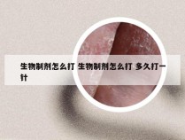 生物制剂怎么打 生物制剂怎么打 多久打一针