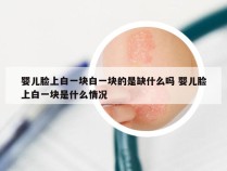 婴儿脸上白一块白一块的是缺什么吗 婴儿脸上白一块是什么情况
