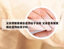 父亲得银屑病会遗传给子女吗 父亲患有银屑病会遗传给孩子吗