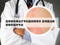 昆明银屑病治疗专科医院哪家好 昆明医治银屑哪家医院专业