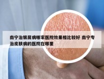 南宁治银屑病哪家医院效果相比较好 南宁专治皮肤病的医院在哪里