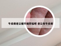 牛皮癣老公嫌不嫌弃贴吧 老公有牛皮癣