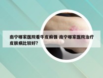 南宁哪家医院看牛皮癣强 南宁哪家医院治疗皮肤病比较好?