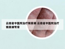 云南省中医院治疗银屑病 云南省中医院治疗银屑病专家