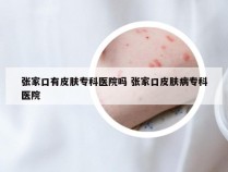 张家口有皮肤专科医院吗 张家口皮肤病专科医院