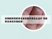 生物制剂司库奇尤单抗副作用怎么治疗 司库奇尤单抗作用机理