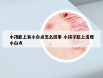 小孩脸上有小白点怎么回事 小孩子脸上出现小白点