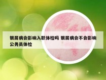银屑病会影响入职体检吗 银屑病会不会影响公务员体检