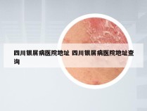 四川银屑病医院地址 四川银屑病医院地址查询