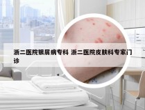 浙二医院银屑病专科 浙二医院皮肤科专家门诊