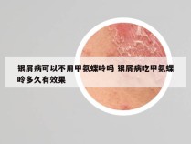 银屑病可以不用甲氨蝶呤吗 银屑病吃甲氨蝶呤多久有效果