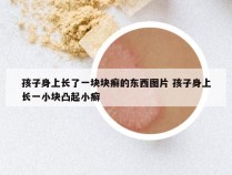 孩子身上长了一块块癣的东西图片 孩子身上长一小块凸起小癣