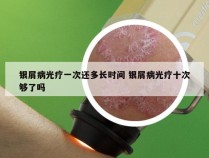 银屑病光疗一次还多长时间 银屑病光疗十次够了吗