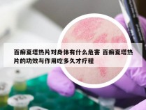 百癣夏塔热片对身体有什么危害 百癣夏塔热片的功效与作用吃多久才疗程
