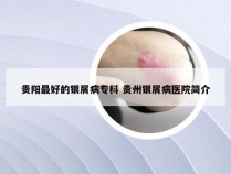 贵阳最好的银屑病专科 贵州银屑病医院简介