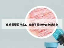 皮癣需要忌什么口 皮癣不能吃什么全部食物