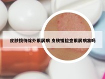 皮肤镜待除外银屑病 皮肤镜检查银屑病准吗