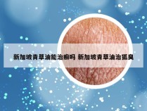 新加坡青草油能治癣吗 新加坡青草油治狐臭