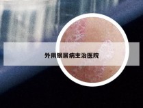 外阴银屑病主治医院