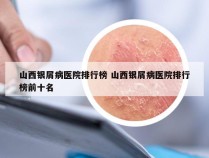 山西银屑病医院排行榜 山西银屑病医院排行榜前十名