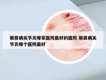 银屑病关节炎哪家医院最好的医院 银屑病关节炎哪个医院最好