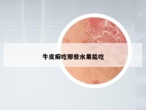 牛皮癣吃那些水果能吃