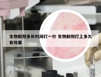 生物制剂多长时间打一针 生物制剂打上多久有效果