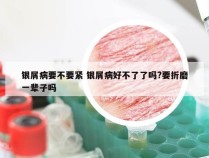 银屑病要不要紧 银屑病好不了了吗?要折磨一辈子吗