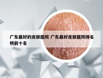 广东最好的皮肤医院 广东最好皮肤医院排名榜前十名