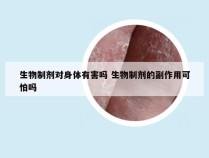 生物制剂对身体有害吗 生物制剂的副作用可怕吗