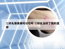 二妙丸银屑病可以吃吗 二妙丸治好了我的湿疹