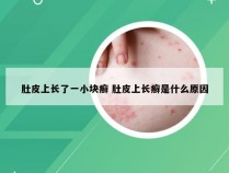 肚皮上长了一小块癣 肚皮上长癣是什么原因