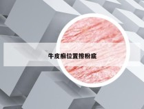 牛皮癣位置擦粉底