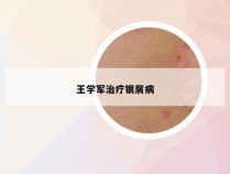王学军治疗银屑病